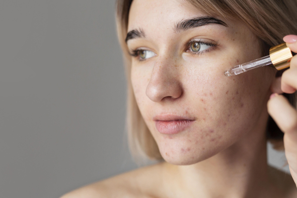 Укол от прыщей: как вакцина может изменить подход к лечению акне