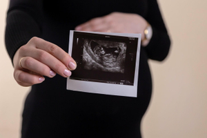 «Мать поможет, Бог поможет»: как в России женщин отговаривают делать аборт