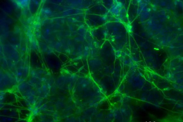 Нейроны сами решают, когда и сколько выпустить в мозг дофамина