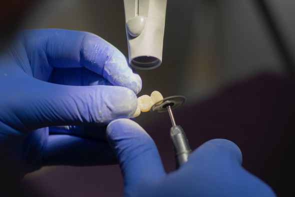 Индийские ученые разработали наноботов для чистки зубов