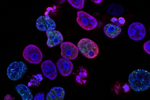 Микробы способствуют развитию раковых опухолей. Что будет, если их убрать?