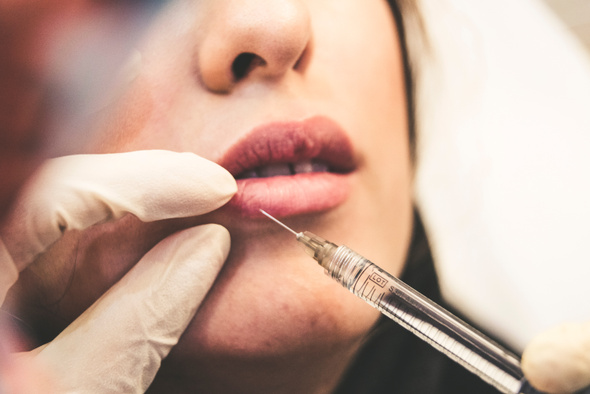 Потеря зрения, язвы и аллергия: почему нельзя колоть филлеры для губ самостоятельно  