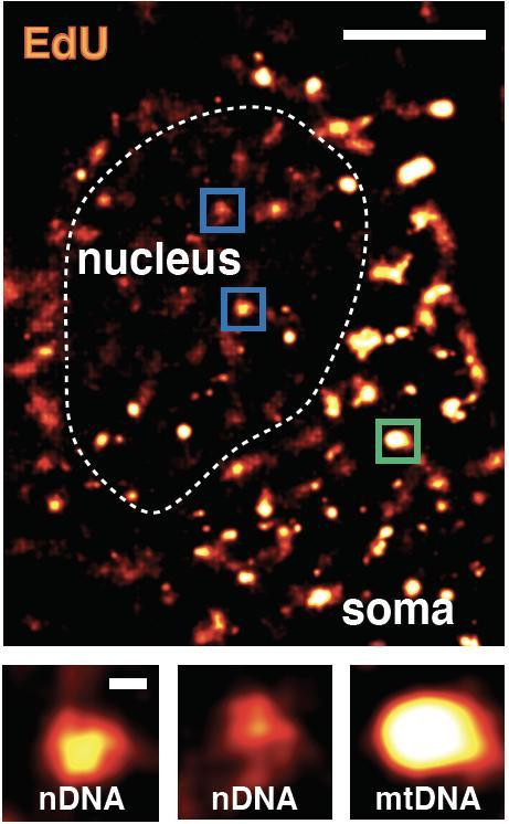 На изображении ядро нейрона, где яркие точки — области генетического восстановления / Salk Institute / Waitt Advanced Biophotonics Center