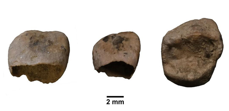 Три зуба младенца, которые исследовали с помощью рентгеновской компьютерной микротомографии. Скриншот: nature.com