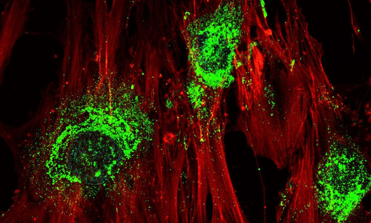 Увеличенное изображение, показывающее взрослые стволовые клетки в процессе превращения в клетки кости после обработки высокочастотными звуковыми волнами. Зеленая окраска показывает наличие коллагена, который превращается в костные клетки. Увеличение: 60X. Фото: rmit 