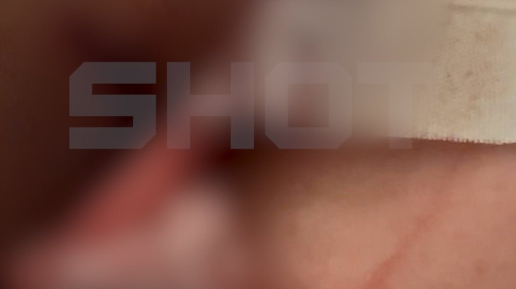 Shot/Telegram