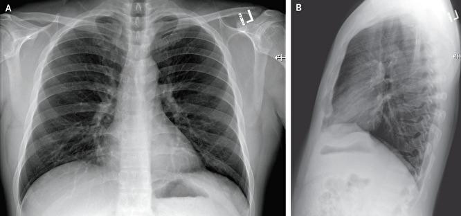 Фото: nejm.org