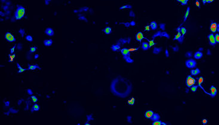 Фото: M.W. Boudreau et al., Science Translational Medicine (2021)