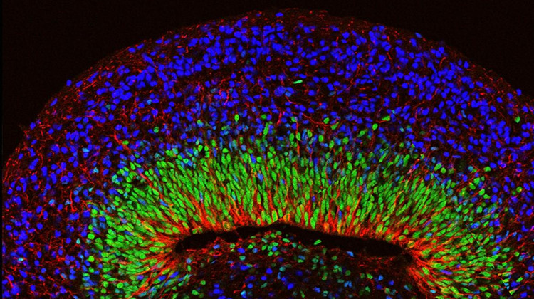 Фото: UCLA Broad Stem Cell Research Center / Nature Neuroscience