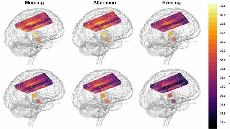 N Rzechorzek/MRC LMB/Brain