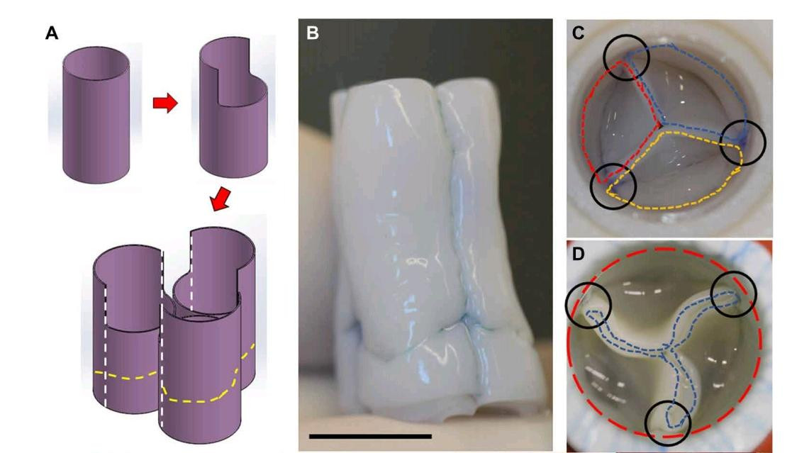 Схема сборки искусственного клапана из трех трубок (А). Клапан нового дизайна (С) и старого, «трубка-в-трубке» (D). Штрихами обозначены отдельные трубки, черным обведены швы на месте соединения трубок.  Фото: Zeeshan H. Syedain et al. / Science Translational Medicine, 2021