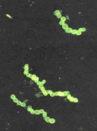 Протеобактерия Thiomargarita namibiensis. Фото: Wikimedia Commons